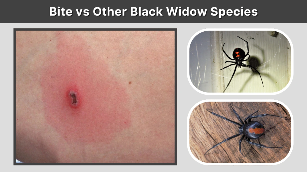 Bite vs Other Black Widow Species