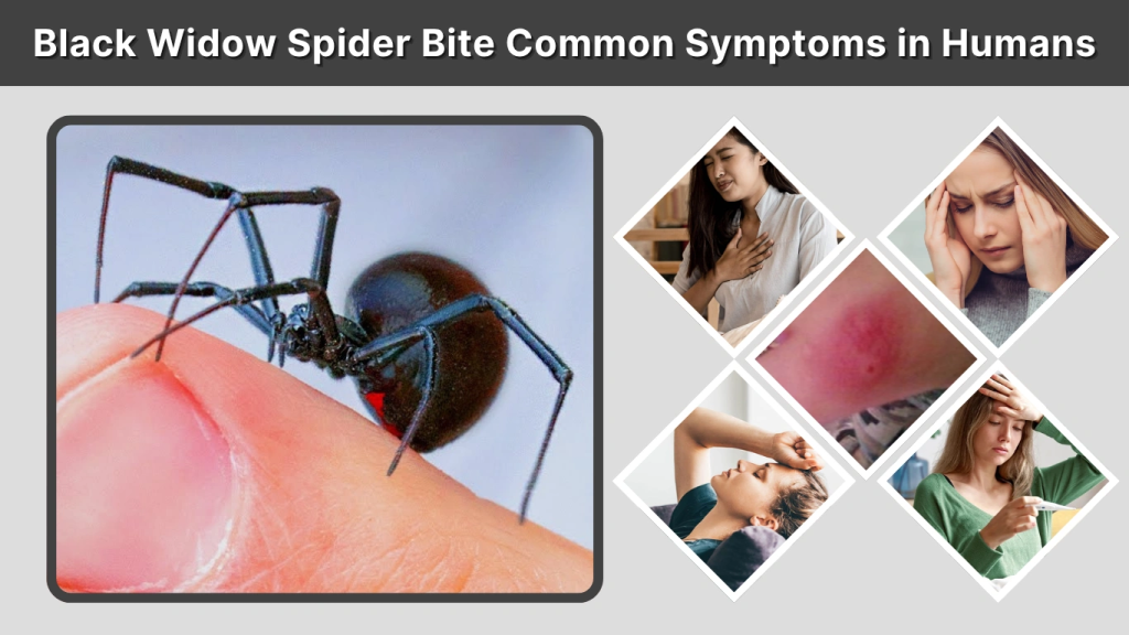 Black Widow Spider Bite Common Symptoms in Humans