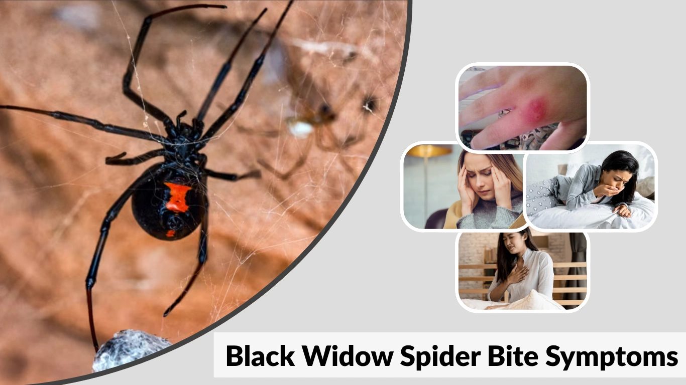 Black Widow Spider Bite Symptoms Signs, Timeline, and Treatment