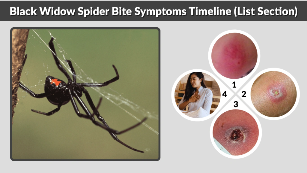 Black Widow Spider Bite Symptoms Timeline (List Section)