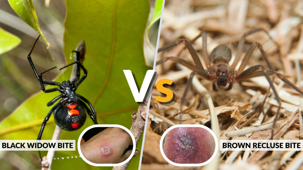 Black Widow vs Brown Recluse Spider Bite