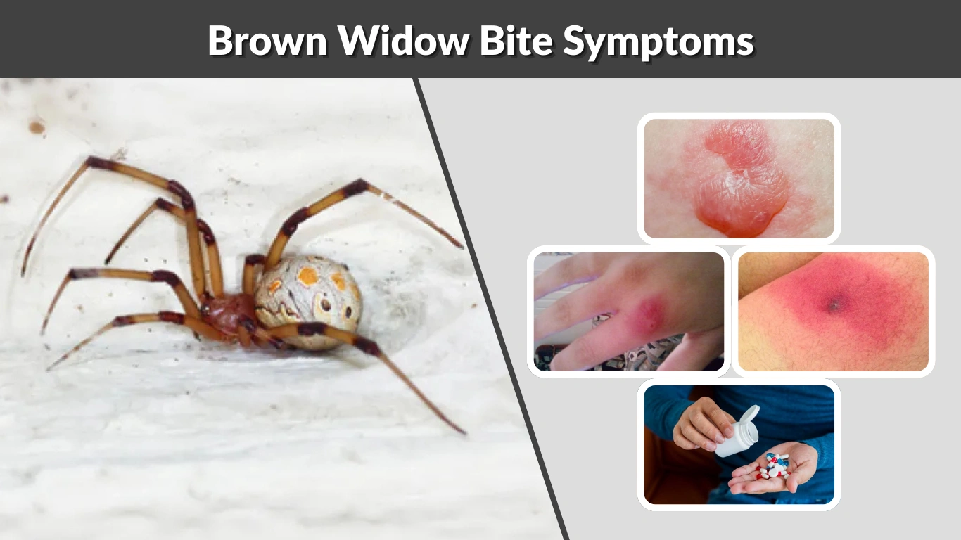 Brown Widow Bite Symptoms, Pictures & Treatment Guide