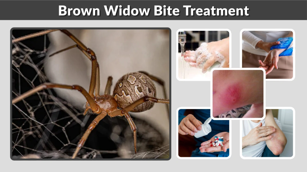 Brown Widow Bite Treatment