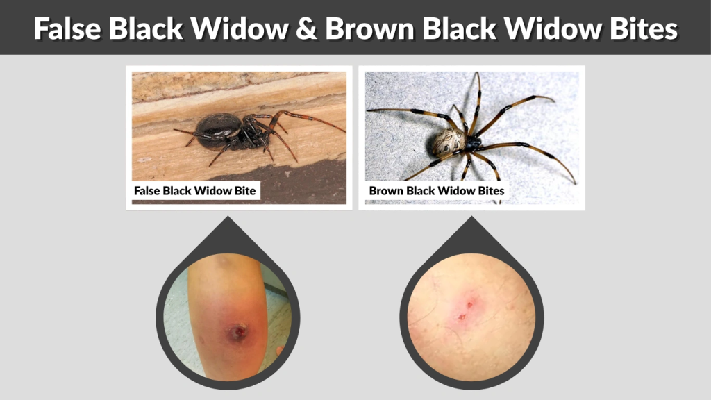 False Black Widow & Brown Black Widow Bites