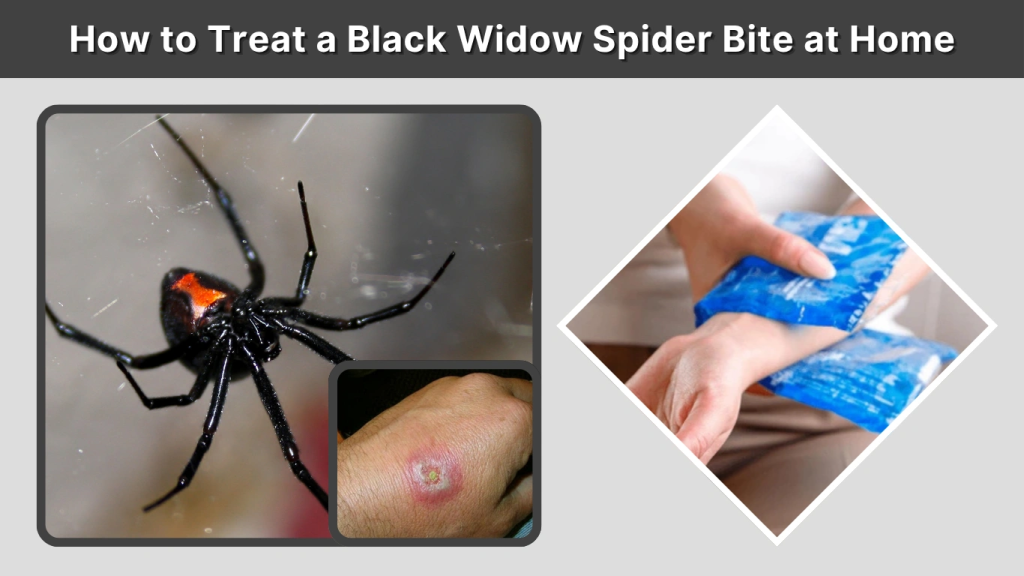 How to Treat a Black Widow Spider Bite at Home