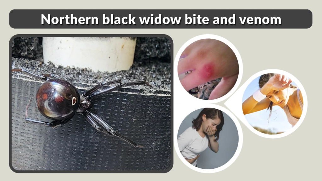Northern black widow bite and venom