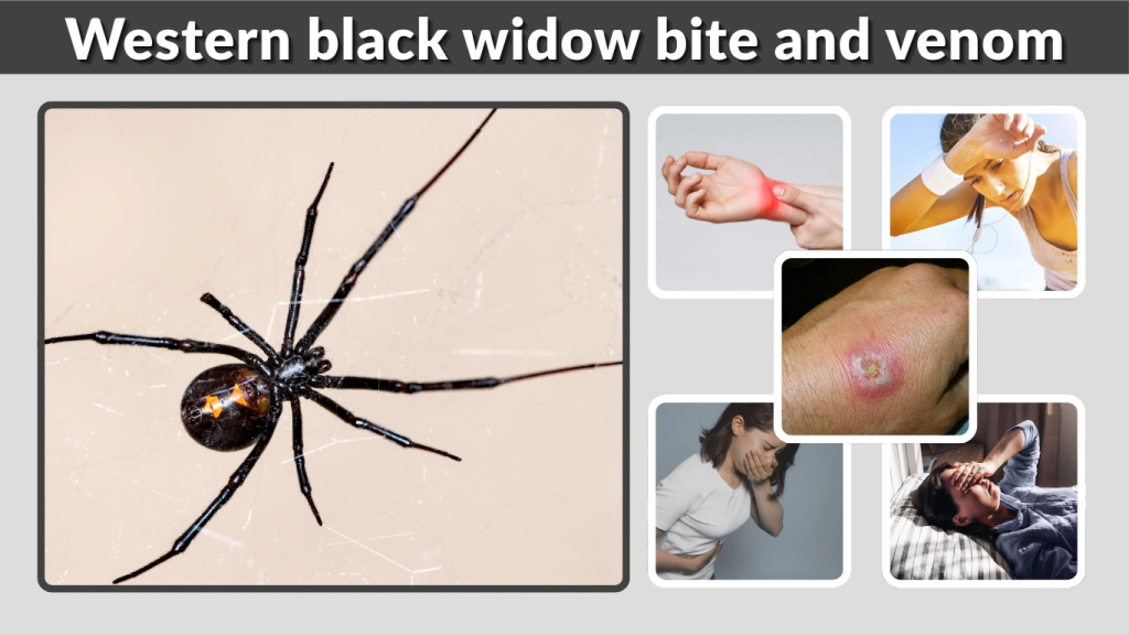 Western black widow bite and venom