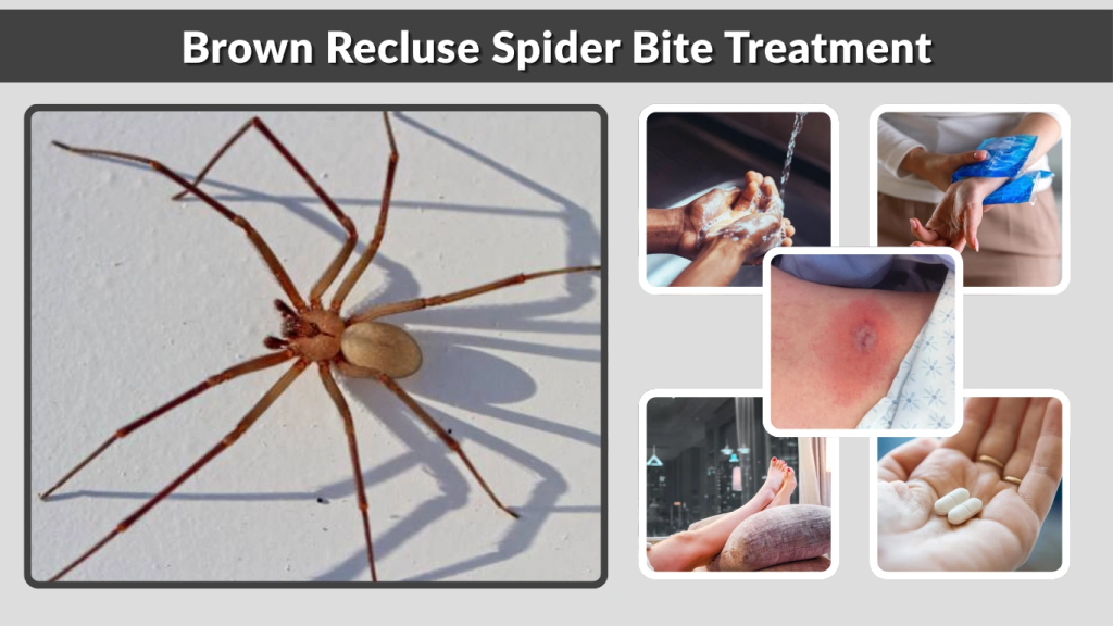Brown Recluse Spider Bite Treatments