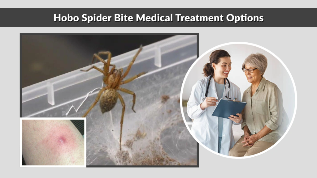 Hobo Spider Bite Medical Treatment Options