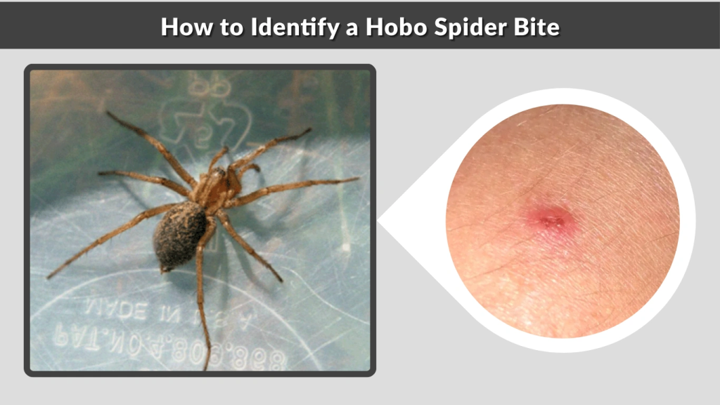 How to Identify a Hobo Spider Bite