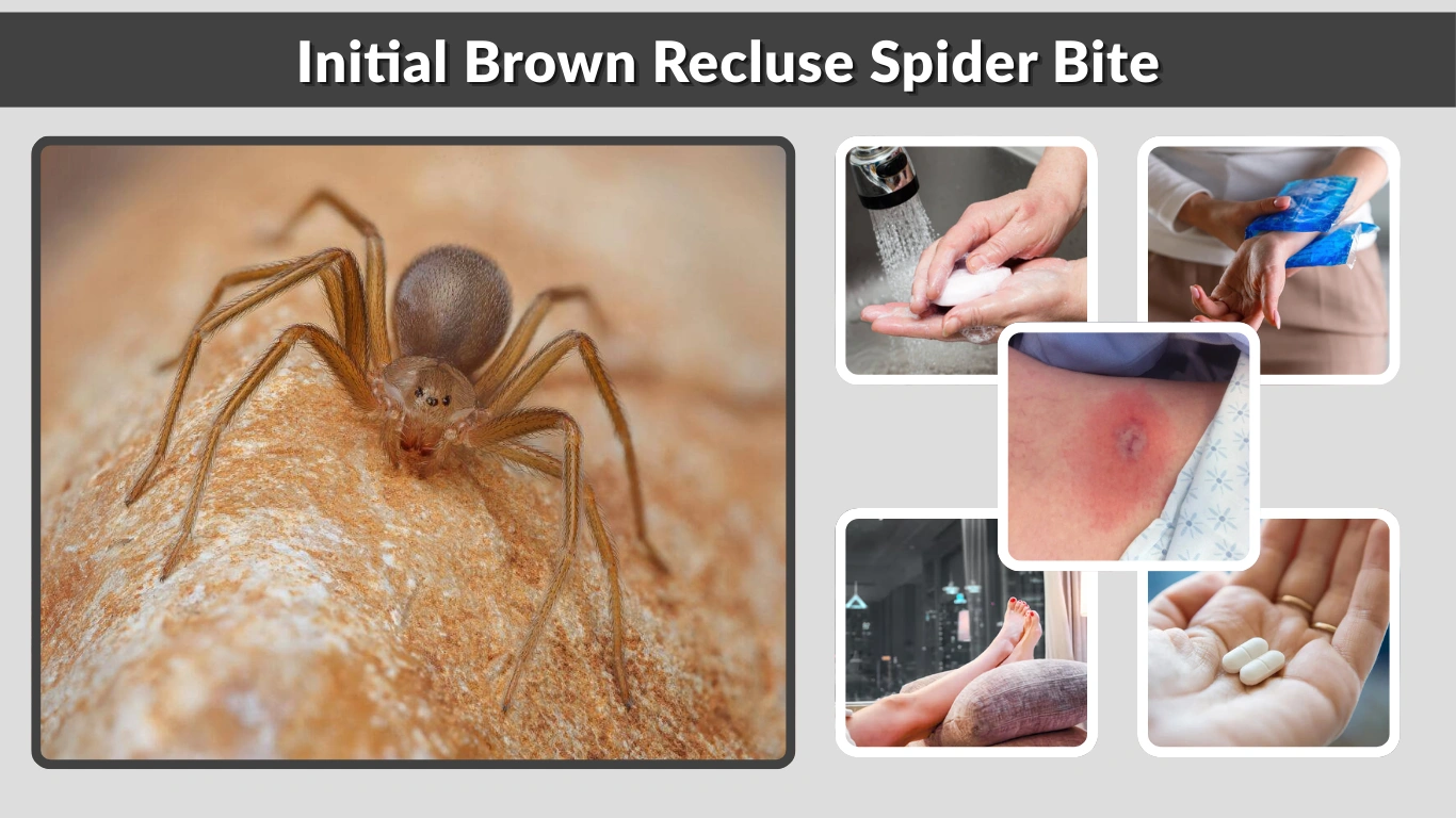 Initial Brown Recluse Spider Bite Early Signs, Timeline, and Treatment