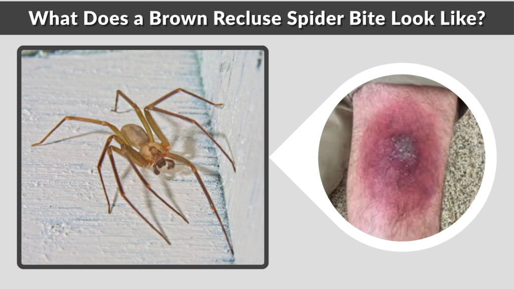 What Does a Brown Recluse Spider Bite Look Like