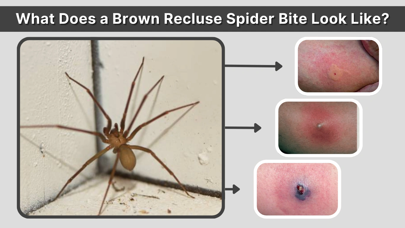 What Does a Brown Recluse Spider Bite Look Like