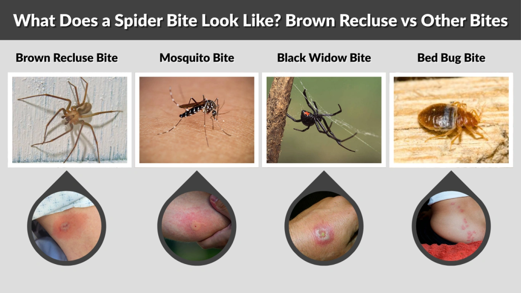 What Does a Spider Bite Look Like Brown Recluse vs Other Bites