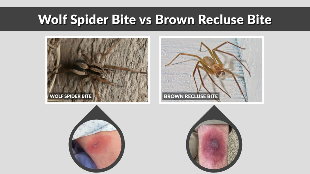 Wolf Spider Bite vs Brown Recluse Bite