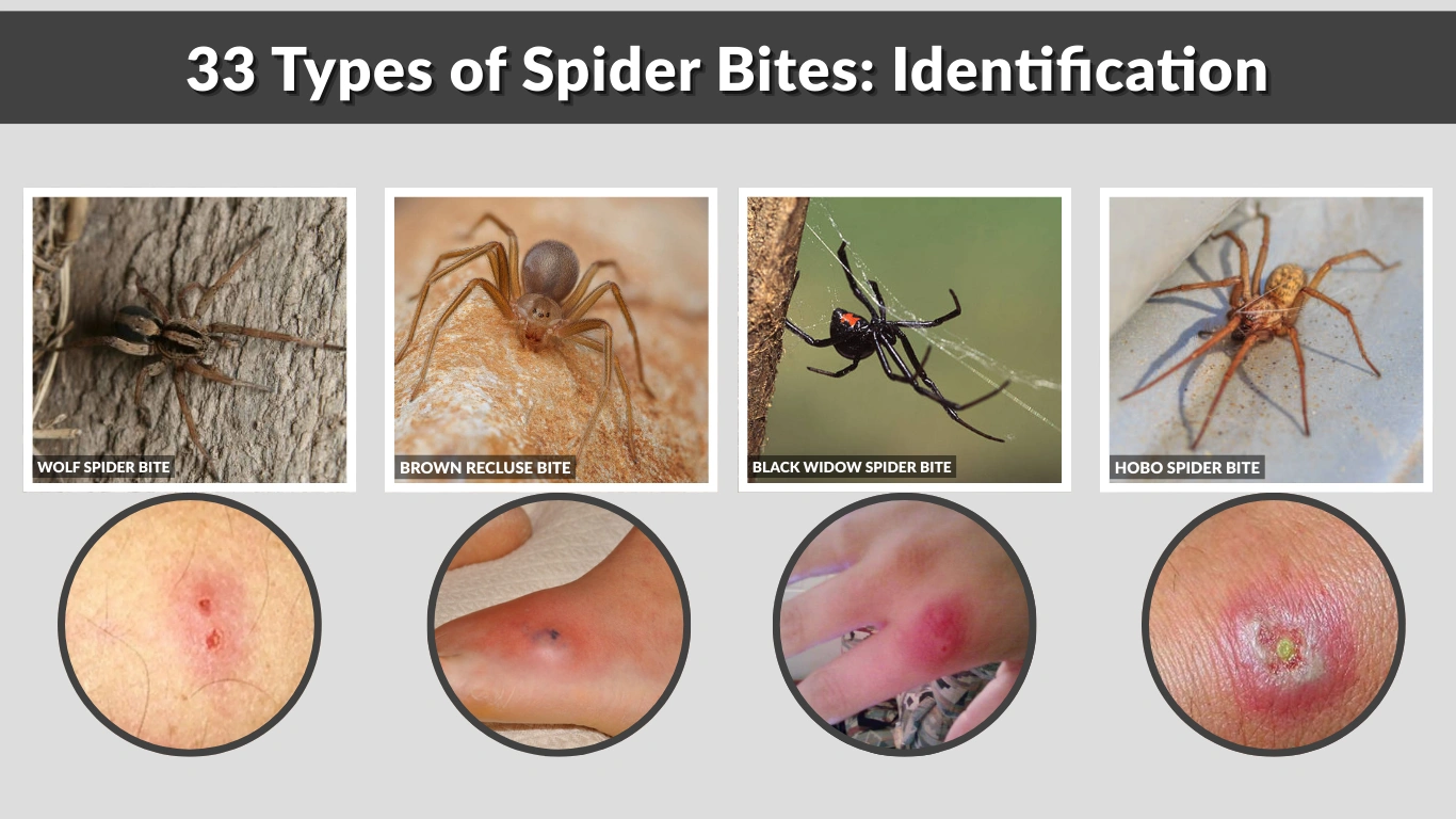 33 Types of Spider Bites Identification, Danger Levels, and Pictures 