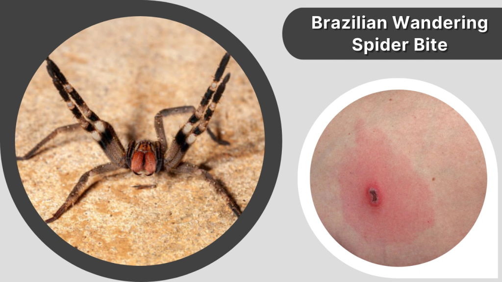 Brazilian Wandering Spider Bite