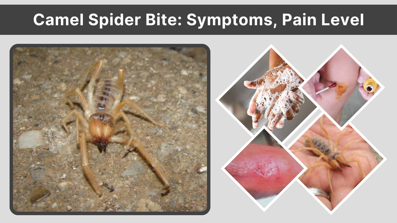 Camel Spider Bite Symptoms, Pain Level, Treatment, and Myths