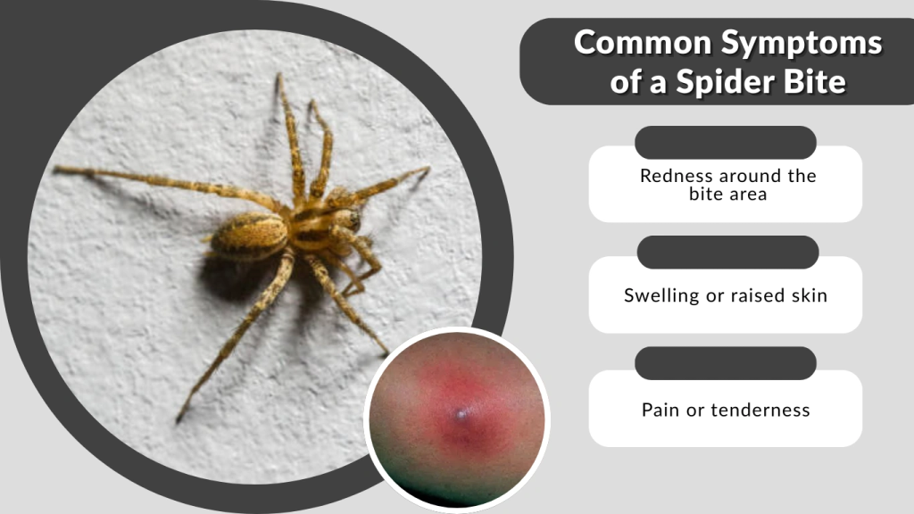 Common Symptoms of a Spider Bite
