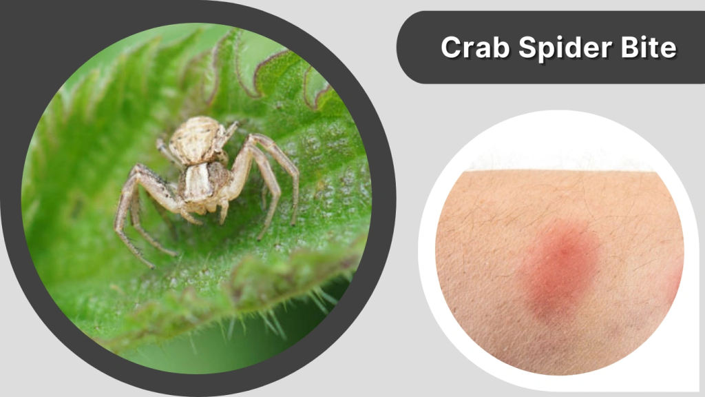 Crab Spider Bite