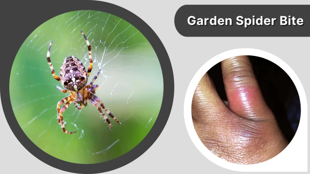Garden Spider Bite