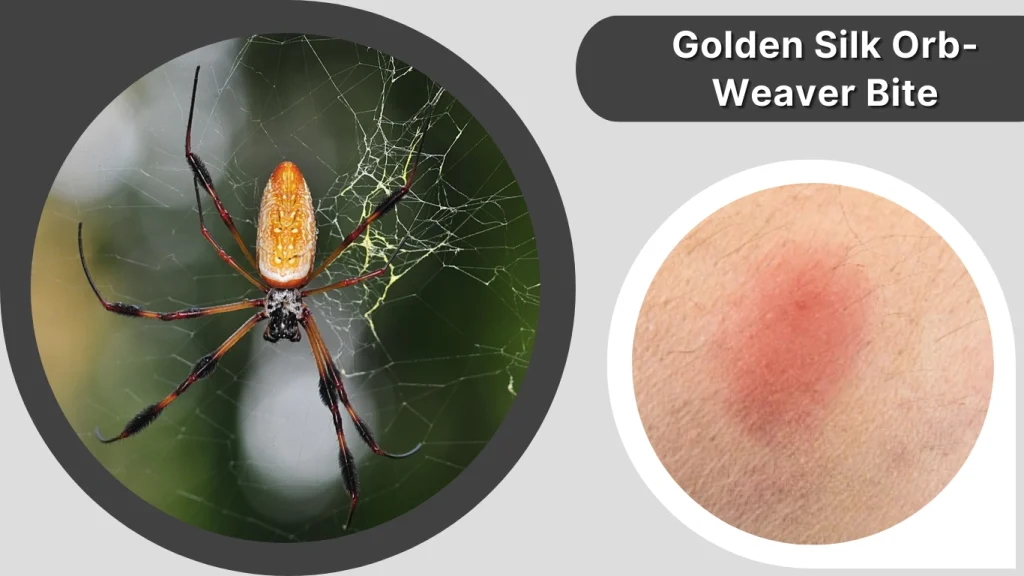 Golden Silk Orb-Weaver Bite