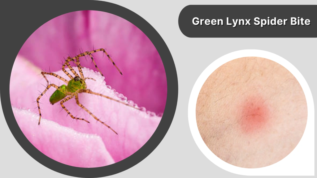 Green Lynx Spider Bite
