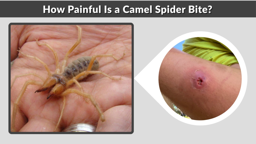 How Painful Is a Camel Spider Bite