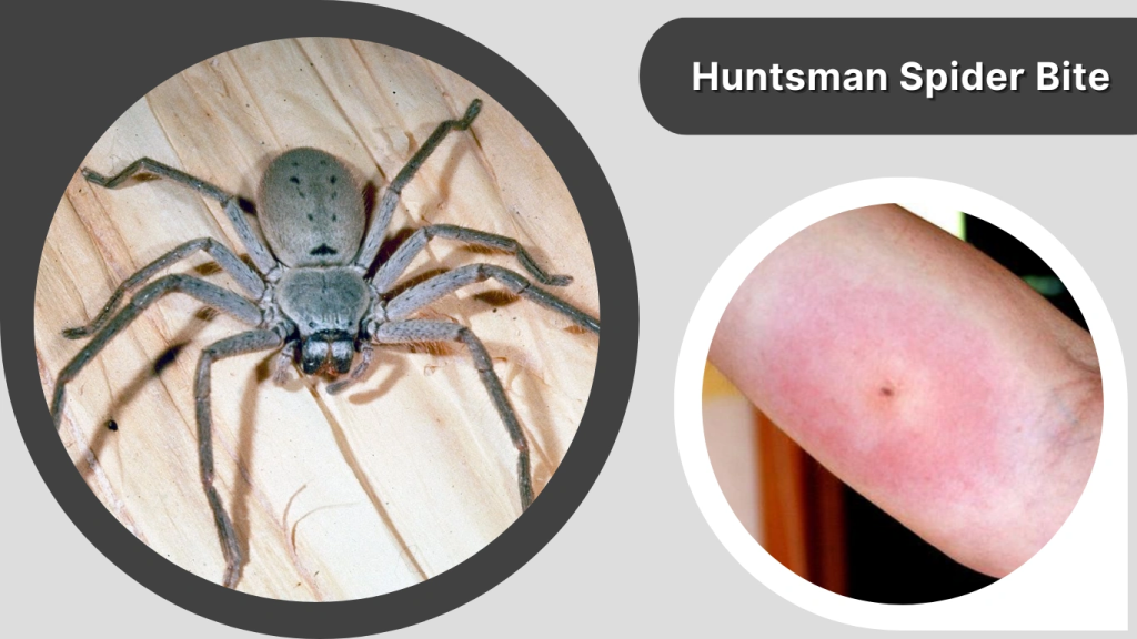 Huntsman Spider Bite