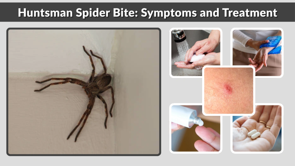 Huntsman Spider Bite Symptoms and Treatment