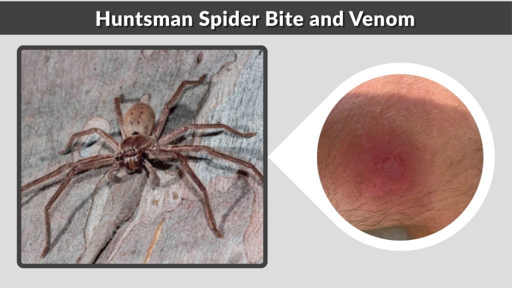 Huntsman Spider Bite and Venom