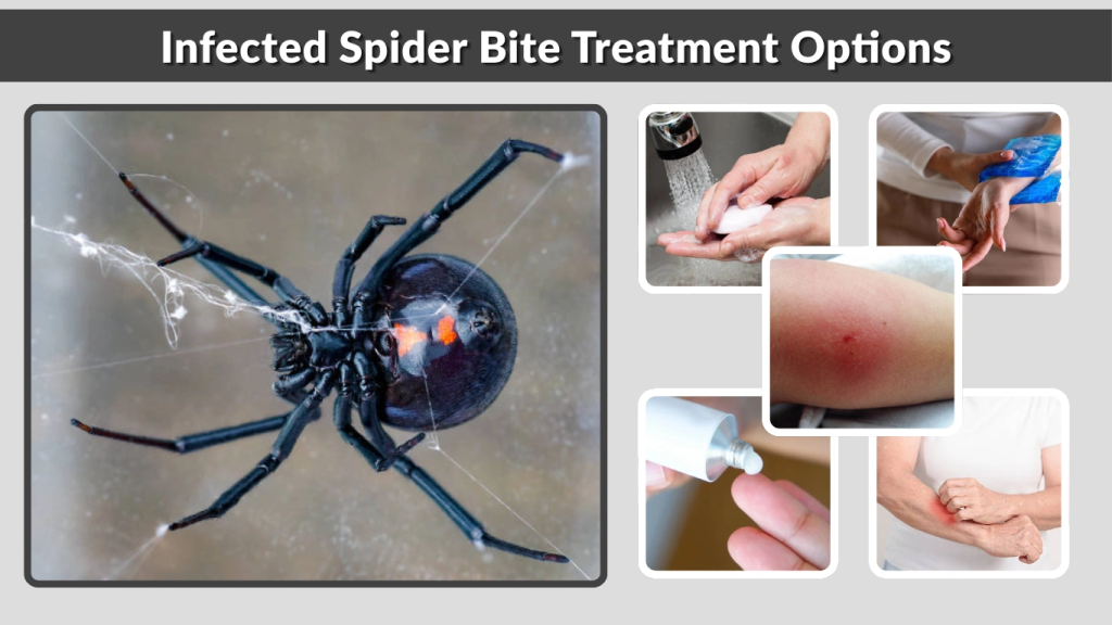 Infected Spider Bite Treatment Options