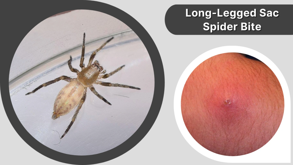 Long-Legged Sac Spider Bite