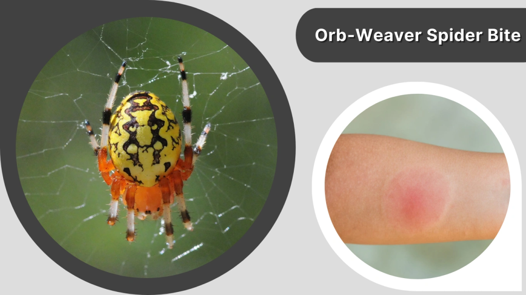 Orb-Weaver Spider Bite