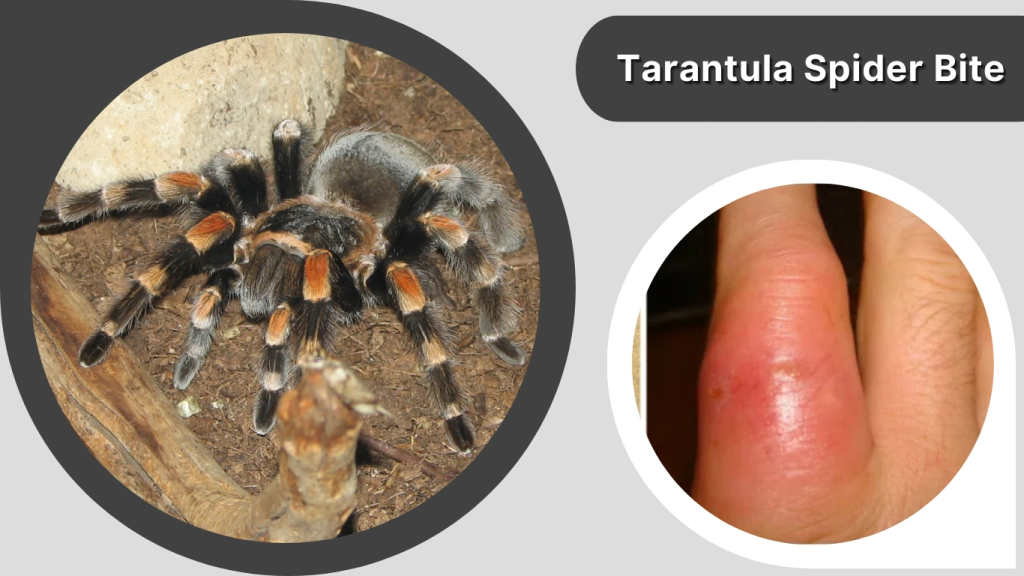 Tarantula Spider Bite