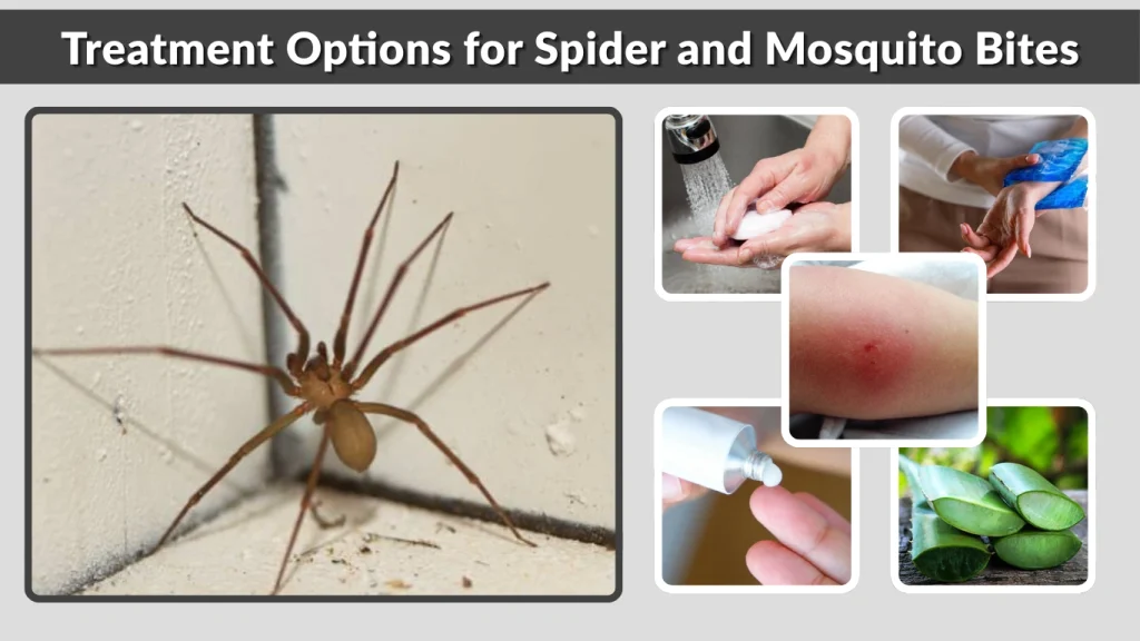 Treatment Options for Spider and Mosquito Bites