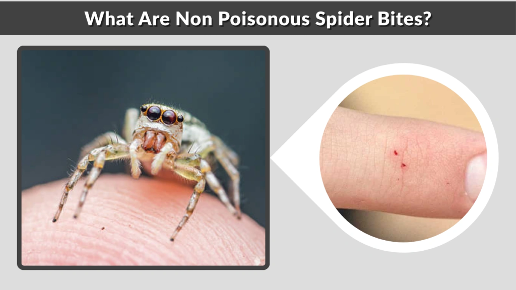 What Are Non Poisonous Spider Bites