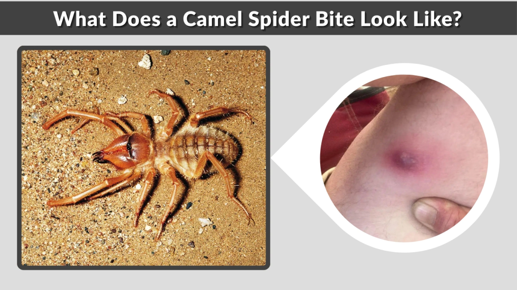 What Does a Camel Spider Bite Look Like