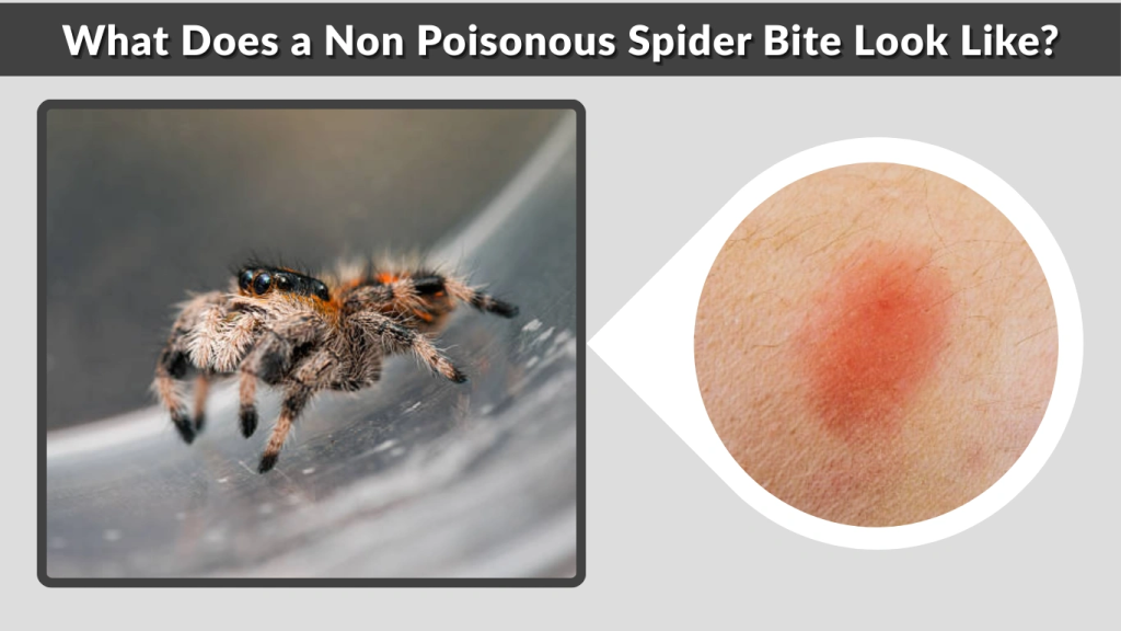 What Does a Non Poisonous Spider Bite Look Like