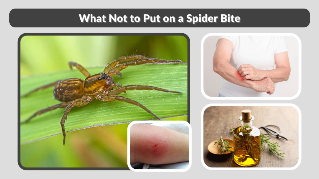 What Not to Put on a Spider Bite
