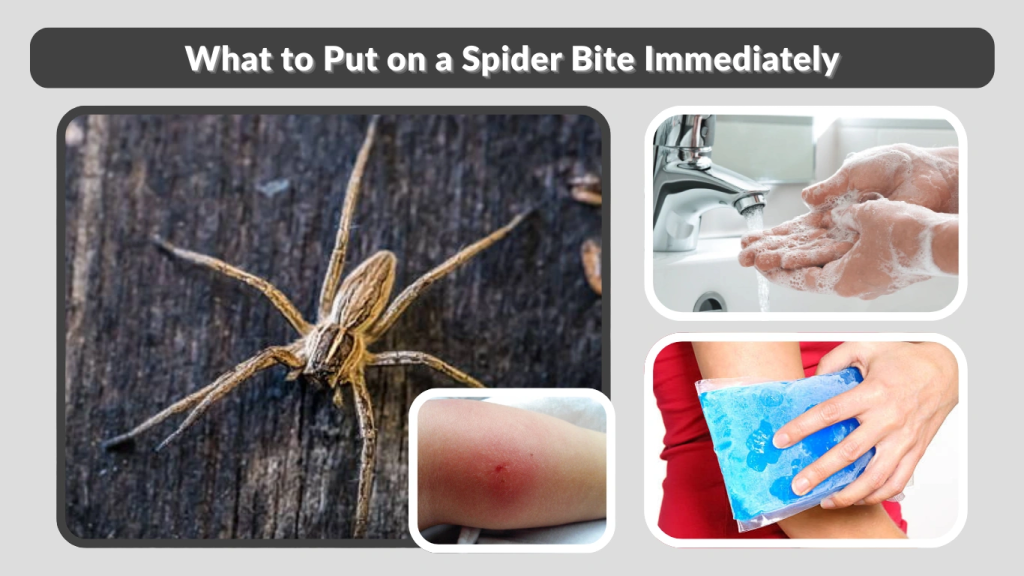 What to Put on a Spider Bite Immediately