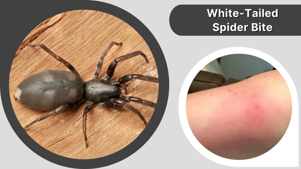 White-Tailed Spider Bite