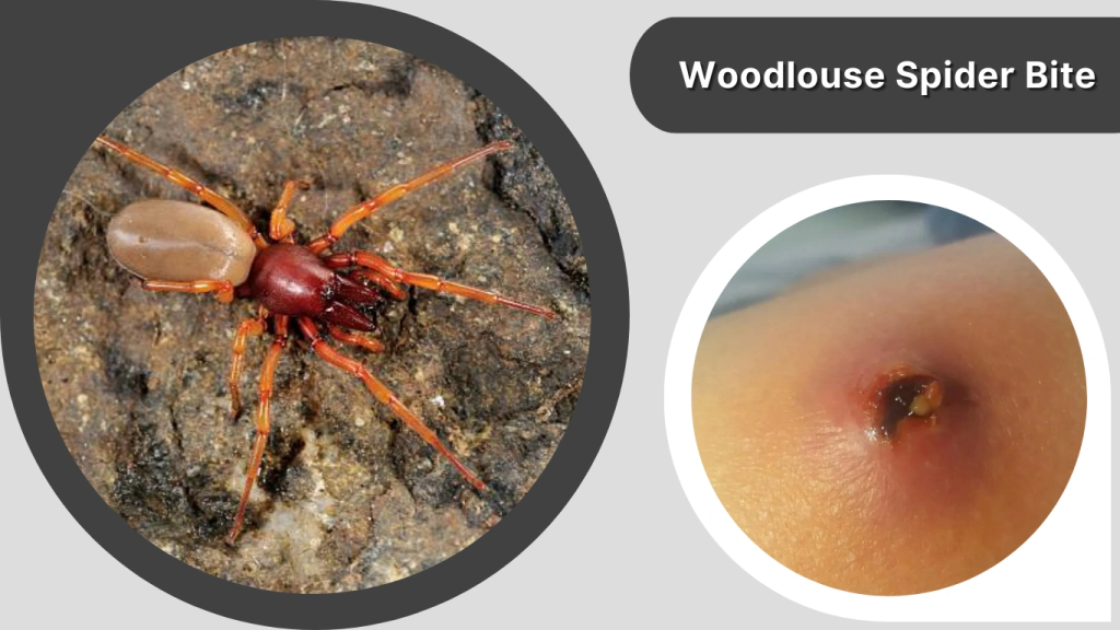 Woodlouse Spider Bite
