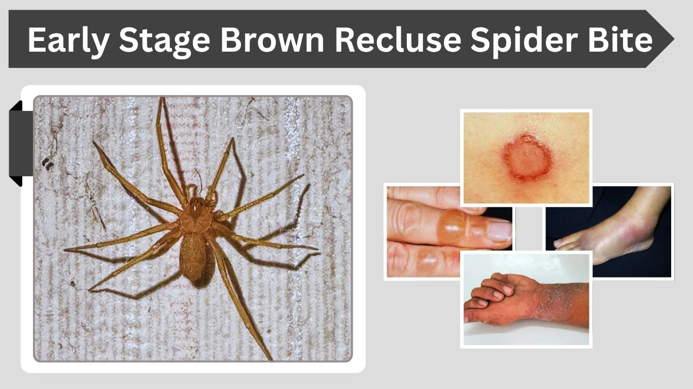 How to Prevent Brown Recluse Spider Bites