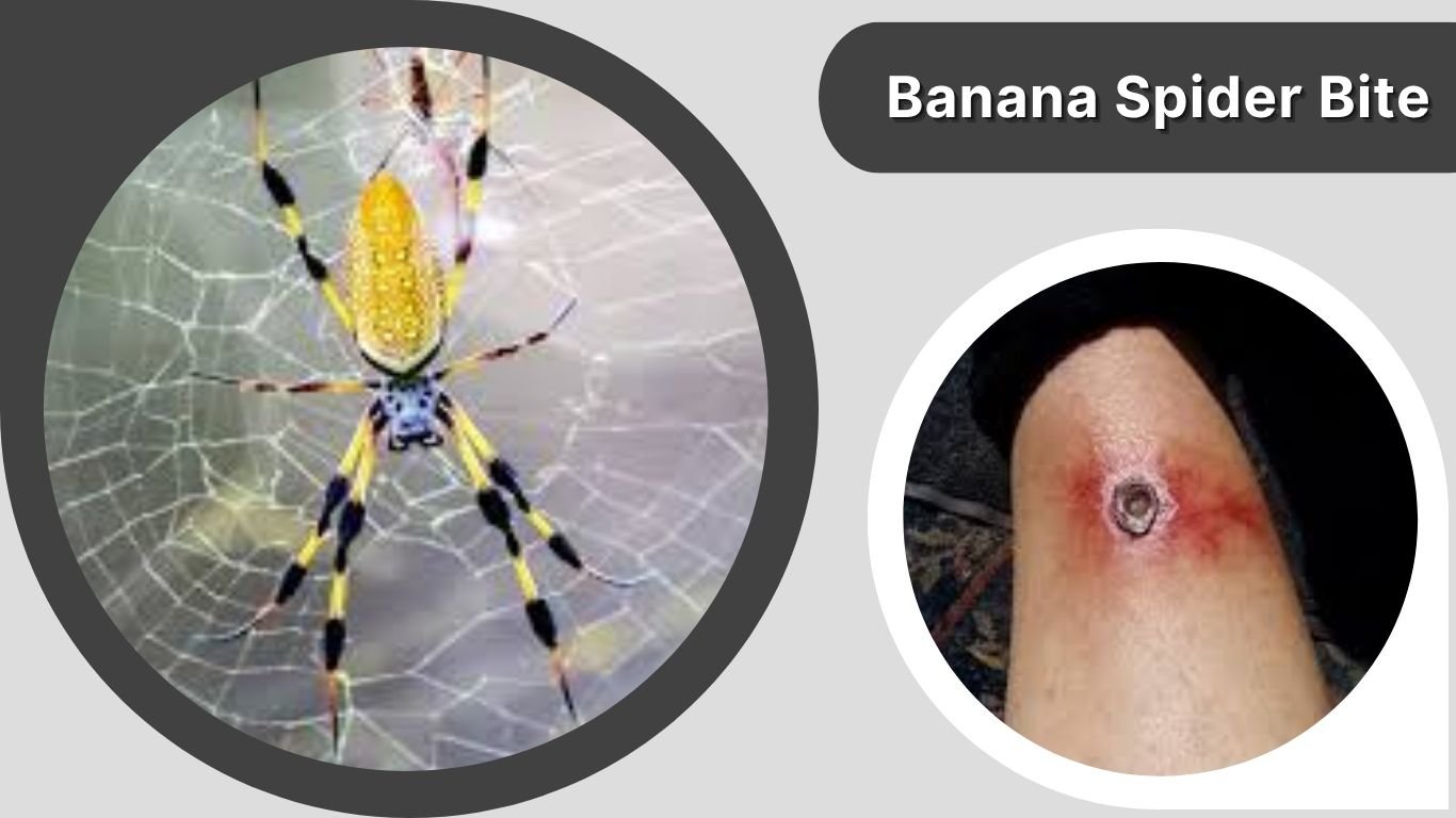 Spider Bite Raspberry Like 30 Types of Spider Bites: Symptoms, Risks & Treatment Guide