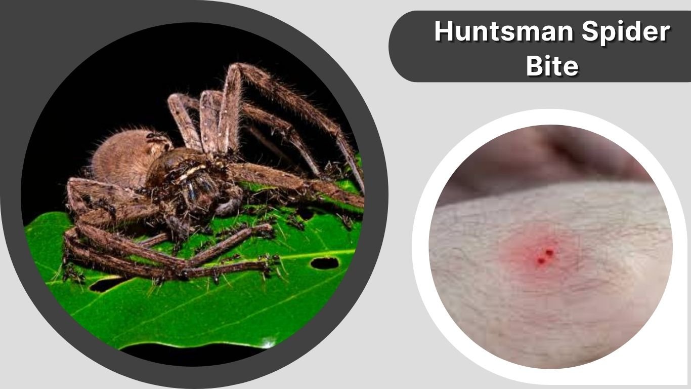 30 Types of Spider Bites: Symptoms, Risks & Treatment Guide