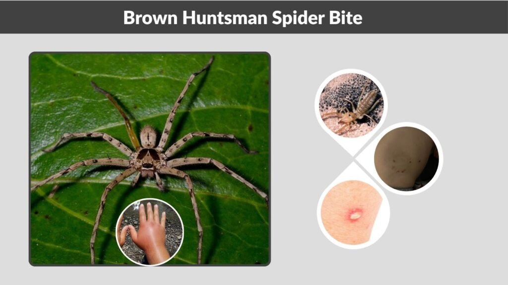 Brown Huntsman Spider Bite