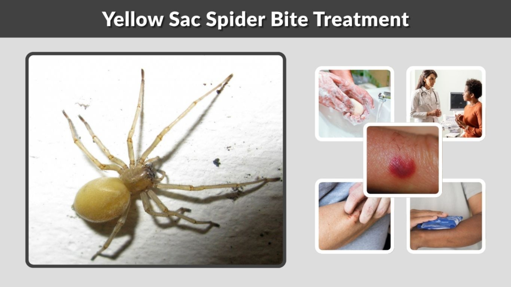 Yellow Sac Spider Bite Treatment