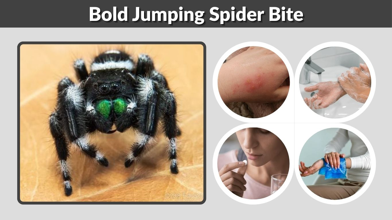 Bold Jumping Spider Bite: Symptoms, Look and Treatment