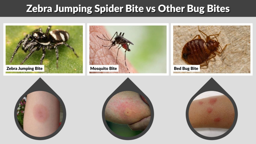 Zebra Jumping Spider Bite vs Other Bug Bites